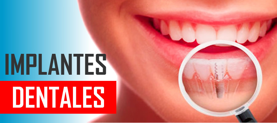 PELICULAS ANTISOLARES